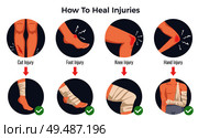 Open cut wounds knee elbow bruises foot injury treatments concept round flat icons bandage applications vector illustration. Стоковая иллюстрация, агентство Ingram Publishing / Фотобанк Лори
