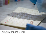 Blood test.Microbiological examination of blood. Стоковое фото, фотограф Лазаренко Светлана / Фотобанк Лори