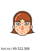 Girl with rash on face, skin problem caused by sickness isolated icon vector. Allergic reaction to natural products, allergy flat style, health care. Girl with Rash on Face, Skin Problem by Sickness. Стоковая иллюстрация, агентство Ingram Publishing / Фотобанк Лори
