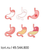 Stomach icon set, cartoon illustration. Стоковая иллюстрация, агентство Ingram Publishing / Фотобанк Лори