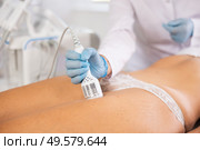 Aesthetician performing cryotherapy using cooling attachment on female client thighs. Стоковое фото, фотограф Яков Филимонов / Фотобанк Лори