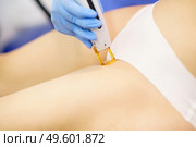 Woman receiving groins laser hair removal at a beauty center. Laser depilation treatment in an aesthetic clinic.. Woman receiving groins laser hair removal at a beauty center. Стоковое фото, агентство Ingram Publishing / Фотобанк Лори