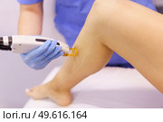 Woman receiving legs laser hair removal at a beauty center. Laser depilation treatment in an aesthetic clinic.. Woman receiving legs laser hair removal at a beauty center. Стоковое фото, агентство Ingram Publishing / Фотобанк Лори