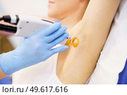 Woman receiving underarm laser hair removal at a beauty center. Laser depilation treatment in an aesthetic clinic.. Woman receiving underarm laser hair removal at a beauty center. Стоковое фото, агентство Ingram Publishing / Фотобанк Лори