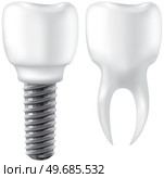 Realistic white dental implant and human tooth. Dentistry, medicine and oral cavity health concept. Denture construction, dental prosthesis structure. Information banner about teeth and implants. Realistic white dental implant and human tooth. Dentistry, medicine and oral cavity health. Стоковая иллюстрация, агентство Ingram Publishing / Фотобанк Лори