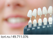 Numbered individual false teeth for colour match. Стоковое фото, агентство Ingram Publishing / Фотобанк Лори