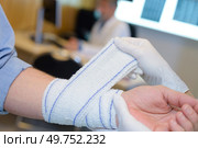close up of wrapping the fractured arm. Стоковое фото, агентство Ingram Publishing / Фотобанк Лори
