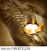 Human burning back pain and backache medical concept with a grunge old document of an upper torso body skeleton with the spine and vertebral column being burnt with fire flames and smoke as a health care symbol for spinal problems. Стоковое фото, агентство Ingram Publishing / Фотобанк Лори