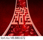 Blood circultation problems and blocked arteries health care concept with a human artery that has a blockage shaped as a maze or labyrinth as a metaphor for the medical challenges ofpoor blood cell flow and circulatory illness. Стоковое фото, агентство Ingram Publishing / Фотобанк Лори