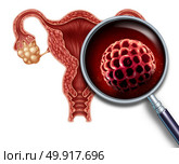 Early pregnancy blastocyst implanted inside a human uterus as a fertilization medical concept as an implantation and reproductive cell division icon in reproduction representing anatomy fertility success symbol in a 3D illustration. Стоковое фото, агентство Ingram Publishing / Фотобанк Лори