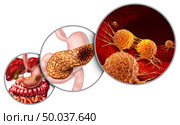 Pancreas cancer anatomy diagram and pancreatic malignant tumor concept as a medical symbol of a digestive gland body part with a microscopic magnification of mutating cells dividing and spreading with 3D illustration elements. Стоковое фото, агентство Ingram Publishing / Фотобанк Лори