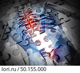 Physiotherapy and bach ache pain rehabilitation as a physical therapy treatment concept in a 3D illustration style. Стоковое фото, агентство Ingram Publishing / Фотобанк Лори