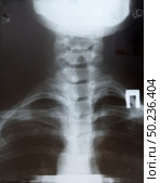 RX diagnostic of neck. Element of design. Стоковое фото, агентство Ingram Publishing / Фотобанк Лори
