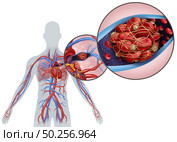 Pulmonary Embolism with a blood clot as a disease with a blockage of an artery in the lungs with 3D illustration elements. Стоковое фото, агентство Ingram Publishing / Фотобанк Лори