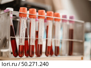 COVID-19 test and laboratory sample of blood testing for diagnosis new Corona virus infection(novel corona virus disease 2019)from Wuhan with laboratory background. Pandemic infectious concept. Стоковое фото, агентство Ingram Publishing / Фотобанк Лори
