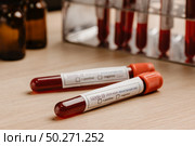 COVID-19 test and laboratory sample of blood testing for diagnosis new Corona virus infection(novel corona virus disease 2019)from Wuhan with laboratory background. Pandemic infectious concept. Стоковое фото, агентство Ingram Publishing / Фотобанк Лори