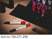 COVID-19 test and laboratory sample of blood testing for diagnosis new Corona virus infection(novel corona virus disease 2019)from Wuhan with laboratory background. Pandemic infectious concept. Стоковое фото, агентство Ingram Publishing / Фотобанк Лори