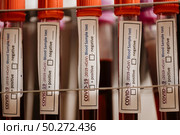 COVID-19 test and laboratory sample of blood testing for diagnosis new Corona virus infection(novel corona virus disease 2019)from Wuhan with laboratory background. Pandemic infectious concept. Стоковое фото, агентство Ingram Publishing / Фотобанк Лори