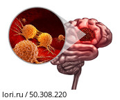 Brain cancer anatomy concept and malignant tumor or tumour symbol as a neurology body part with a microscopic magnification of malignant cells dividing and spreading with 3D illustration elements. Стоковое фото, агентство Ingram Publishing / Фотобанк Лори