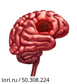 Brain cancer anatomy concept and malignant tumor symbol as a neurology body part with a microscopic magnification of malignant cells dividing and spreading with 3D illustration elements. Стоковое фото, агентство Ingram Publishing / Фотобанк Лори