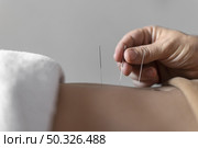 close up hand holding acupuncture needle. Resolution and high quality beautiful photo. close up hand holding acupuncture needle. High quality beautiful photo concept. Стоковое фото, агентство Ingram Publishing / Фотобанк Лори