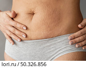 close up woman with stretch marks. Beautiful photo. close up woman with stretch marks. Стоковое фото, агентство Ingram Publishing / Фотобанк Лори