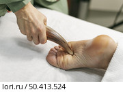 man suction session. Стоковое фото, агентство Ingram Publishing / Фотобанк Лори