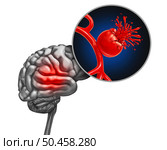 Ruptured brain Aneurysm as a medical concept with a bulging blood vessel as a ballooning artery with a rupture bleeding blood and causing a risk of hemorrhagic stroke as a 3D illustration. Стоковое фото, агентство Ingram Publishing / Фотобанк Лори