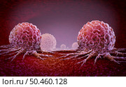 Cancer oncology and Malignant Cancerous Growth and Metastasis anatomy concept as growing tumor cells and Malignancy disease spreading metastasized on an organ inside the human body as a 3D illustration. Стоковое фото, агентство Ingram Publishing / Фотобанк Лори
