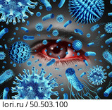 Conjunctivitis Eye Infection or infected Pink eyes as a bacterial and viral infections or allergic reaction and allergies as an ophthalmology or optometry symbol with 3D illustration elements. Стоковое фото, агентство Ingram Publishing / Фотобанк Лори