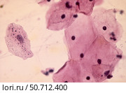 A cytologic smear of vagina with intermediate squamous cells. Стоковое фото, фотограф National Institutes of Health /Stocktrek/Stocktrek Images / ТАСС / Фотобанк Лори