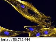 Immunofluorescence image of actin bundles in muscle precursor cells called myoblasts. Стоковое фото, фотограф National Institutes of Health /Stocktrek/Stocktrek Images / ТАСС / Фотобанк Лори