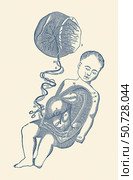 Diagram of the placenta and umbilical cord attached to a baby and position of removal placenta removal. Стоковое фото, фотограф Vernon Lewis Gallery/Stocktrek Images / ТАСС / Фотобанк Лори
