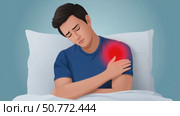 Man suffering from shoulder pain in bed. Стоковое AI-видео, аниматор Юрий Поздников / Фотобанк Лори