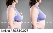 Before and after breast augmentation, woman with large saggy breasts, reduction mammoplasty, plastic surgery, aesthetic, healthcare and medicine concept. Стоковое фото, фотограф Станислав Тарко / Фотобанк Лори