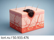 Detailed Representation of Human Skin Structure Highlighting Hair Follicles, Blood Vessels, and the Dermis Layer for Educational Purpose. Стоковое AI-изображение, AI-художник Башкирова Анна / Фотобанк Лори