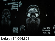 Close-up of magnetic resonance imaging of the human brain. Стоковое фото, фотограф Михаил Решетников / Фотобанк Лори