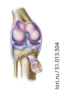 Front view of knee showing torn medial meniscus. Стоковое фото, фотограф Elise Walmsley-MacWha/Stocktrek Images / ТАСС / Фотобанк Лори
