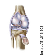 Front view of knee showing torn ACL and meniscus. Стоковое фото, фотограф Elise Walmsley-MacWha/Stocktrek Images / ТАСС / Фотобанк Лори