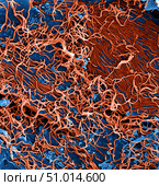 25,000x magnified SEM of filamentous Ebola virus particles (red) Стоковое фото, фотограф Stocktrek Images, Inc. / ТАСС / Фотобанк Лори