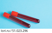 A magnified view of a blood sample. Two medical test tubes filled with human blood are depicted against a blue backdrop. The idea of conducting blood tests is introduced. Стоковое фото, фотограф Скрипачев Антон / Фотобанк Лори