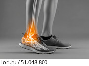 Leg with ankle joint pain icon. Foot wearing running shoes showing the bones in the ankle area. Grey floor. Feet with red effect of painful injury problems. Legs with anatomical detail glowing orange. Стоковое AI-изображение, AI-художник Марина Демидюк / Фотобанк Лори