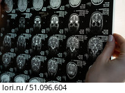 Close-up of magnetic resonance imaging of the human brain. Стоковое фото, фотограф Михаил Решетников / Фотобанк Лори