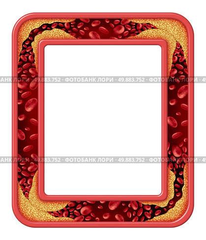 Artery disease frame as a coronary medical concept as a rectangular border design vein with gradual plaque formation as clogged arteries and atherosclerosis as a symbol of a human anatomy diagram of the risks of cholesterol buildup. Стоковое фото, агентство Ingram Publishing / Фотобанк Лори