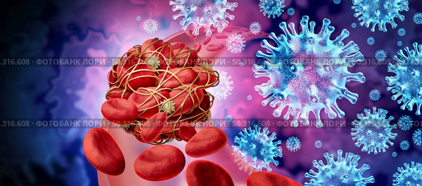 Blood clots and virus infection and Coronavirus or influenza as cells clumped together by sticky platelets and fibrin as a blockage in an artery or vein as a risk of clotting and clot concept with as a 3D render. Стоковое фото, агентство Ingram Publishing / Фотобанк Лори
