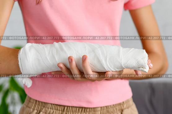 Close-up of a hand with a fracture in a cast. The concept of an accident insured event. Selective focus on bandage with plaster. Стоковое фото, фотограф Никита Бурденков / Фотобанк Лори