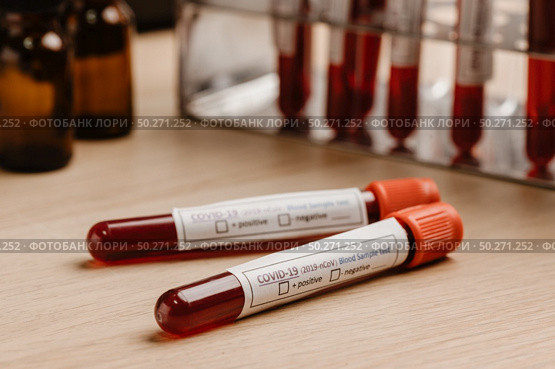 COVID-19 test and laboratory sample of blood testing for diagnosis new Corona virus infection(novel corona virus disease 2019)from Wuhan with laboratory background. Pandemic infectious concept. Стоковое фото, агентство Ingram Publishing / Фотобанк Лори