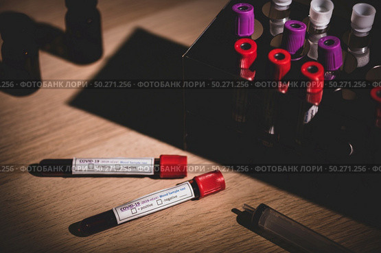 COVID-19 test and laboratory sample of blood testing for diagnosis new Corona virus infection(novel corona virus disease 2019)from Wuhan with laboratory background. Pandemic infectious concept. Стоковое фото, агентство Ingram Publishing / Фотобанк Лори