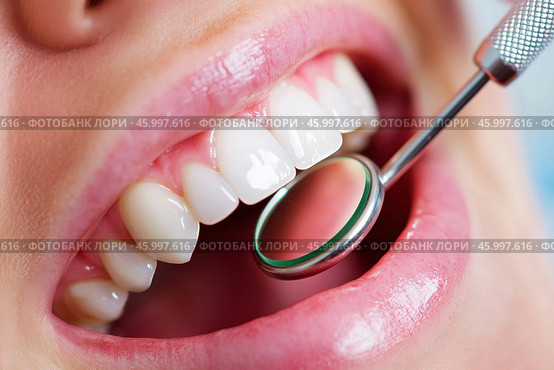 Dental examination, woman with toothache, periodontal disease in wisdom teeth, gum inflammation, dental pain, health problems concept. Стоковое AI-изображение, AI-художник Станислав Тарко / Фотобанк Лори