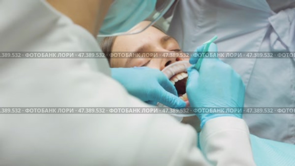 Dentist applying adhesive to patients teeth before aligner placement during orthodontic procedure. Стоковое видео, видеограф Дмитрий Наумов / Фотобанк Лори
